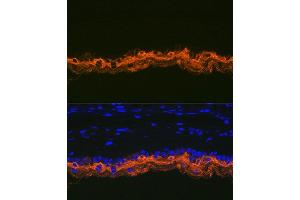 Immunofluorescence (IF) image for anti-Keratin 2 (KRT2) antibody (ABIN1680763)