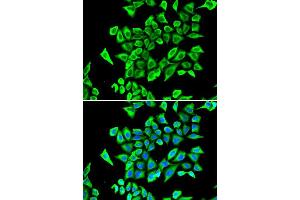 Immunofluorescence analysis of A549 cell using LCN2 antibody. (Lipocalin 2 抗体  (AA 21-198))