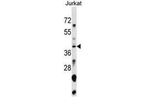 SNAPC1 Antibody (Center) western blot analysis in Jurkat cell line lysates (35µg/lane). (SNAPC1 抗体  (Middle Region))
