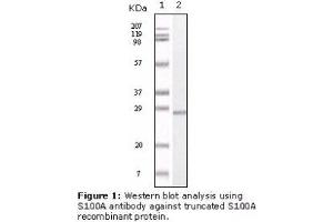 Image no. 2 for anti-S100 Calcium Binding Protein A1 (S100A1) antibody (ABIN232125) (S100A1 抗体)