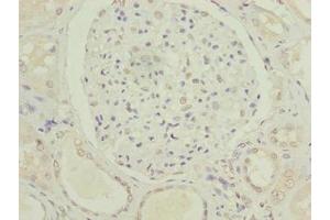 Immunohistochemistry of paraffin-embedded human kidney tissue using ABIN7175021 at dilution of 1:100 (C5orf24 抗体  (AA 7-188))