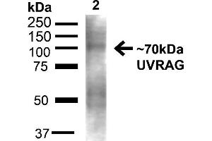 Western blot analysis of Rat Liver showing detection of ~70kDa UVRAG protein using Rabbit Anti-UVRAG Polyclonal Antibody . (UVRAG 抗体  (C-Term) (FITC))