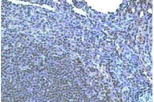 Immunohistochemistry (IHC) image for anti-Chemokine (C-C Motif) Receptor 10 (CCR10) antibody (ABIN2477947)