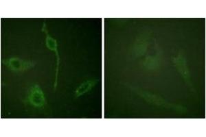 Immunofluorescence analysis of HeLa cells, using PDGFR alpha (Ab-762) Antibody. (PDGFRA 抗体  (AA 731-780))