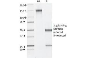 SDS-PAGE Analysis of Purified, BSA-Free Estrogen Receptor beta Antibody (clone ESR2/686). (ESR2 抗体  (C-Term))