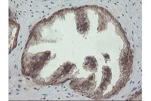 Image no. 1 for anti-Phosphoinositide-3-Kinase, Catalytic, gamma Polypeptide (PIK3CG) antibody (ABIN1500207) (PIK3 gamma 抗体)