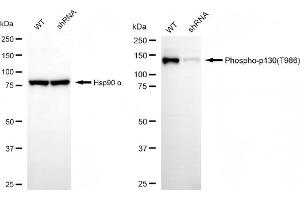 Western blotting analysis using phospho-p130 (T986) antibody (ABIN7799666). (Recombinant NOLC1 抗体  (pThr986))