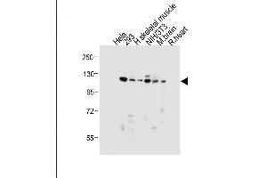 All lanes : Anti-Dnmt3a Antibody at 1:1000 dilution Lane 1: Hela whole cell lysate Lane 2: 293 whole cell lysate Lane 3: Human skeletal muscle tissue lysate Lane 4: NIH/3T3 whole cell lysate Lane 5: Mouse brain tissue lysate Lane 6: Rat heart tissue lysate Lysates/proteins at 20 μg per lane. (DNMT3A 抗体  (AA 457-486))