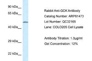 Western Blotting (WB) image for anti-Glucokinase (Hexokinase 4) (GCK) (N-Term) antibody (ABIN2788816) (GCK 抗体  (N-Term))