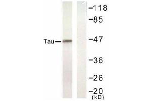 Image no. 1 for anti-Microtubule-Associated Protein tau (MAPT) (Ser422) antibody (ABIN197528) (MAPT 抗体  (Ser422))