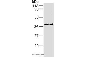 Western blot analysis of Hela cell, using AKR1B1 Polyclonal Antibody at dilution of 1:340 (AKR1B1 抗体)