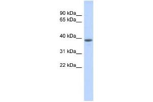 Western Blotting (WB) image for anti-DDB1 and CUL4 Associated Factor 4-Like 1 (DCAF4L1) antibody (ABIN2459760) (DCAF4L1 抗体)