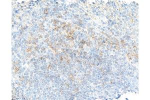 anti-Complement Component (3d/Epstein Barr Virus) Receptor 2 (CR2) (C-Term) antibody