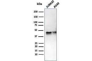 Western Blotting (WB) image for anti-serpin Peptidase Inhibitor, Clade A (Alpha-1 Antiproteinase, Antitrypsin), Member 1 (SERPINA1) antibody (ABIN6940314)