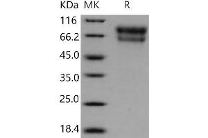SERPINA10 Protein (His tag)