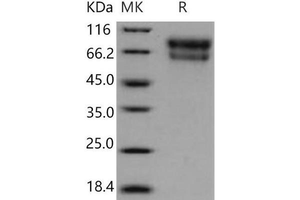 SERPINA10 Protein (His tag)