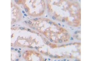 Used in DAB staining on fromalin fixed paraffin- embedded Kidney tissue (NOMO1 抗体  (AA 365-542))