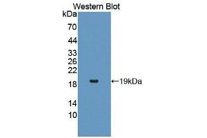 Western blot analysis of the recombinant protein. (IL17RA 抗体  (AA 377-534))