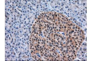 Immunohistochemical staining of paraffin-embedded Human Kidney tissue using anti-TACC3 mouse monoclonal antibody. (TACC3 抗体)