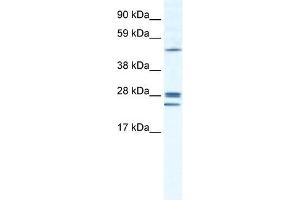 GJB2 antibody used at 1. (GJB2 抗体  (N-Term))