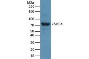 Detection of SLC27A5 in Rat Liver Tissue using Polyclonal Antibody to Solute Carrier Family 27 Member 5 (SLC27A5) (SLC27A5 抗体  (AA 488-690))