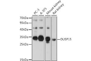 Western blot analysis of extracts of various cell lines, using DUSP15 antibody (ABIN7266846) at 1:1000 dilution. (DUSP15 抗体  (AA 10-90))