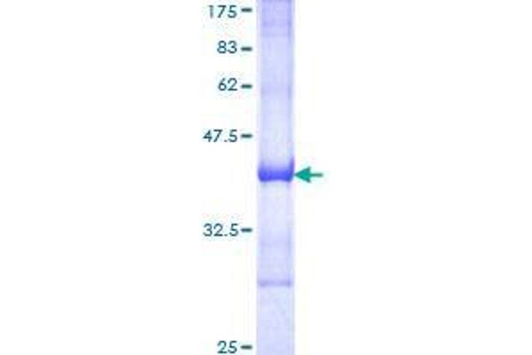 RIN2 Protein (AA 786-894) (GST tag)