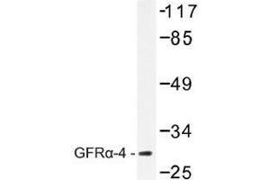 Image no. 1 for anti-GDNF Family Receptor alpha 4 (GFRA4) antibody (ABIN317910) (GFRA4 抗体)