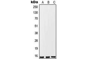 Western blot analysis of FKSG2 expression in A549 (A), Raw264. (FKSG2 抗体  (Center))