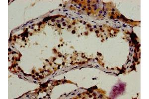 Immunohistochemistry of paraffin-embedded human testis tissue using ABIN7167841 at dilution of 1:100 (RBP1 抗体  (AA 70-112))