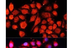 Immunofluorescence analysis of HeLa cells using MRPS28 Polyclonal Antibody at dilution of 1:100 (40x lens). (MRPS28 抗体)