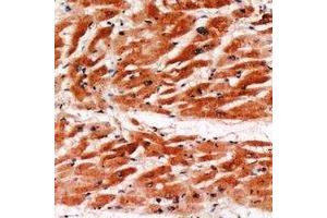 Immunohistochemical analysis of MYBPC3 staining in human heart formalin fixed paraffin embedded tissue section. (MYBPC3 抗体)