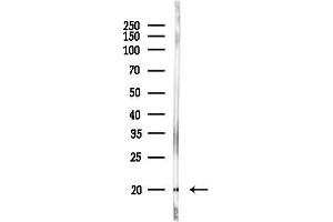 Western blot analysis of lysates from 3-L1 P6, using SO Antibody at 1/1000 dilution.