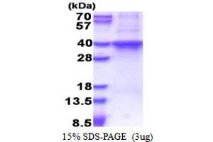 SDS-PAGE (SDS) image for RAD51 Homolog D (RAD51D) (AA 1-328) protein (His tag) (ABIN6387376) (RAD51D Protein (AA 1-328) (His tag))