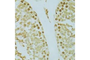 Immunohistochemistry of paraffin-embedded rat testis using RCC1 antibody (ABIN5973761) at dilution of 1/100 (40x lens). (RCC1 抗体)