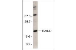 Western Blotting (WB) image for anti-CASP2 and RIPK1 Domain Containing Adaptor with Death Domain (CRADD) (C-Term) antibody (ABIN500563)