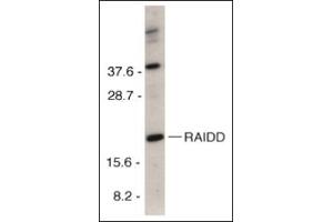 Western blot analysis of RAIDD in HeLa total cell lysate with this product at 1 μg/ml.
