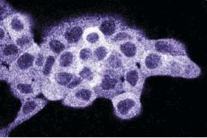 Immunofluorescence staining on A431 cells (Human epithelial carcinoma, ATCC CRL-1555). (Dynamin 1-Like 抗体  (AA 19-201))