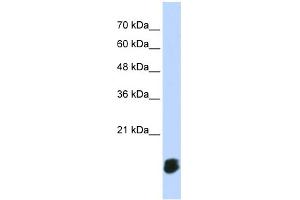 WB Suggested Anti-GLRX5 Antibody Titration: 0. (GLRX5 抗体  (Middle Region))