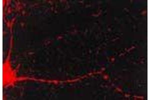Immunocytochemistry/Immunofluorescence analysis using Mouse Anti-CaMKII Monoclonal Antibody, Clone 6G9 . (CAMKII gamma 抗体  (PE))