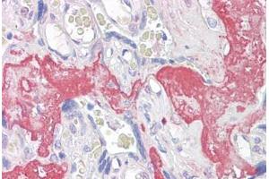 Anti-GAGED2 antibody IHC staining of human placenta. (XAGE1D 抗体  (AA 58-69))