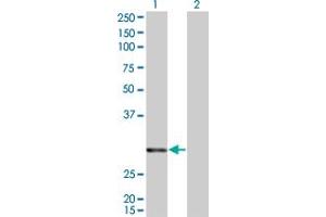 Western Blot analysis of ATF2 expression in transfected 293T cell line by ATF2 monoclonal antibody (M01), clone 4C12. (ATF2 抗体)