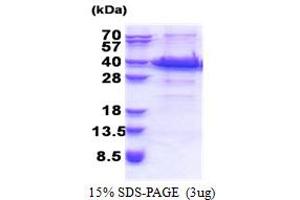 SDS-PAGE (SDS) image for Acyl-CoA Binding Domain Containing 6 (ACBD6) (AA 1-282) protein (His tag) (ABIN5853315) (ACBD6 Protein (AA 1-282) (His tag))