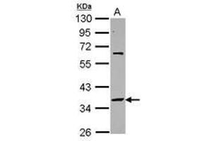 Image no. 1 for anti-Small Nuclear RNA Activating Complex, Polypeptide 2, 45kDa (SNAPC2) (AA 60-290) antibody (ABIN1501022) (SNAPC2 抗体  (AA 60-290))