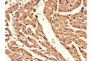 Immunohistochemistry of paraffin-embedded human heart tissue using ABIN7145355 at dilution of 1:100 (ADRB1 抗体  (AA 401-477))