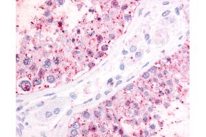 Anti-P2RY1 / P2Y1 antibody IHC of human testis. (P2RY1 抗体  (N-Term))
