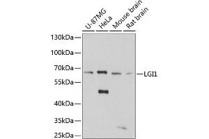 Western blot analysis of extracts of various cell lines, using LGI1 antibody (ABIN7268237) at 1:3000 dilution. (LGI1 抗体  (AA 301-557))