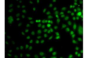 Immunofluorescence analysis of A549 cells using TRPS1 antibody (ABIN5974943). (TRPS1 抗体)