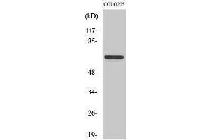 Western Blotting (WB) image for anti-Forkhead Box O4 (FOXO4) (Ser91) antibody (ABIN3175138) (FOXO4 抗体  (Ser91))