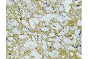 Immunohistochemistry (IHC) image for anti-Synaptophysin (SYP) antibody (ABIN1109181) (Synaptophysin 抗体)
